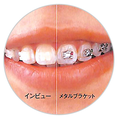 小野歯科医院の歯科矯正