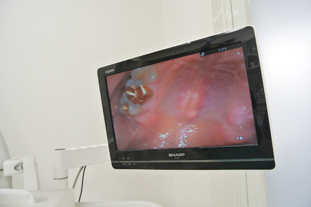 口腔内カメラ