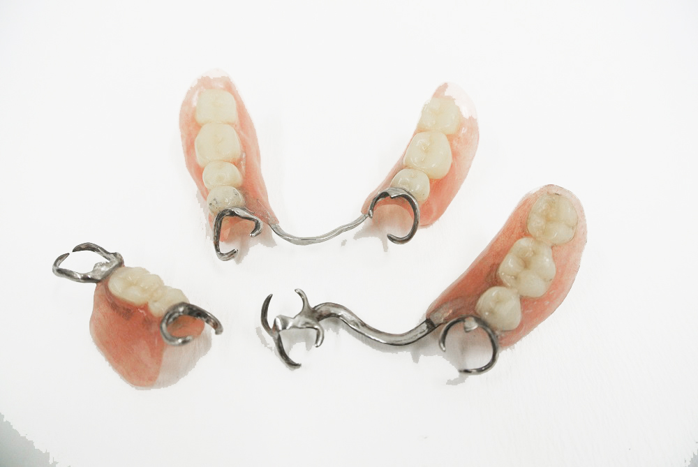 小野歯科医院の義歯