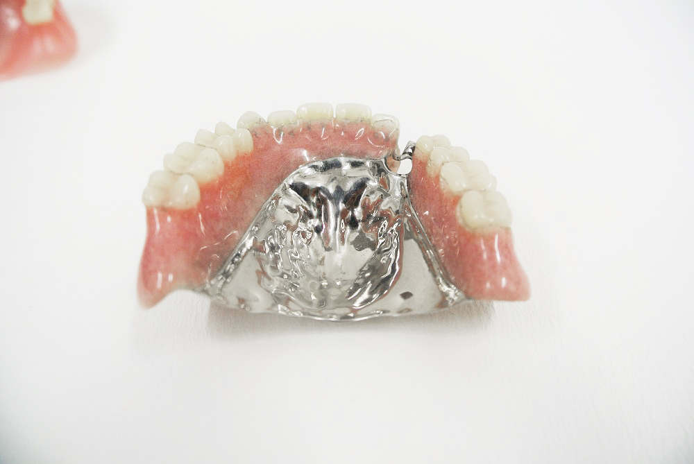 小野歯科医院の義歯