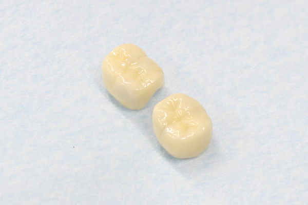 小野歯科医院の審美歯科